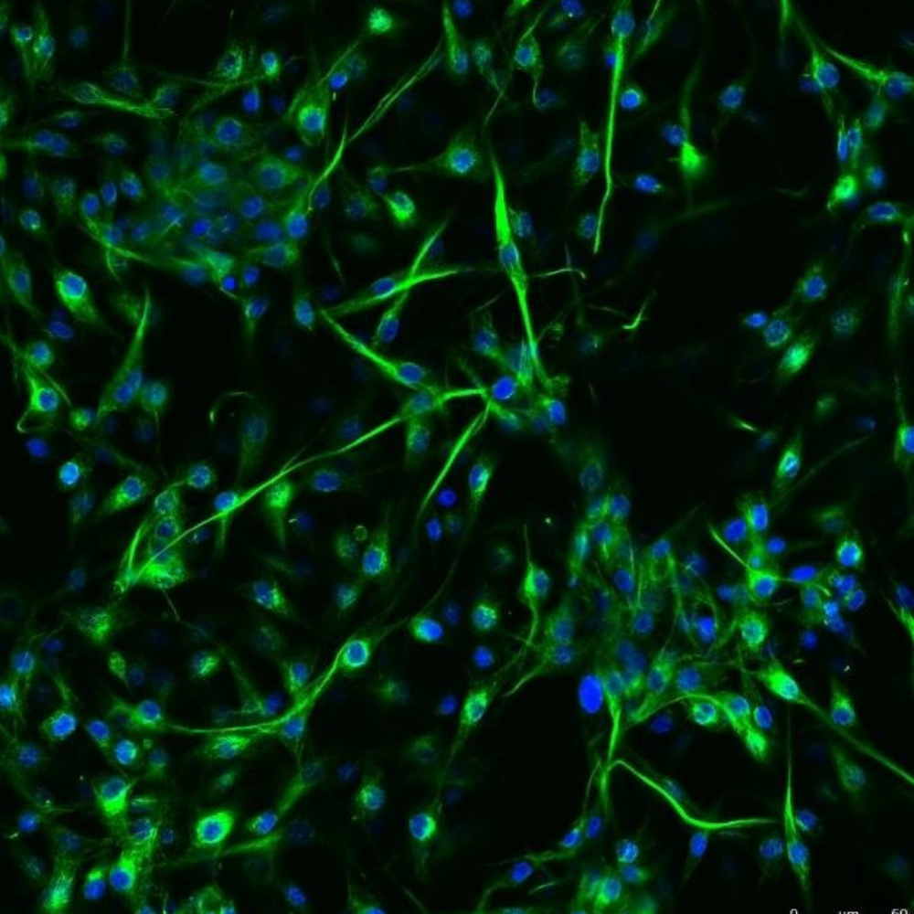 Linea di ricerca 1. Doppia immunofluorescenza di cellule neurali con marker citoscheletrici.