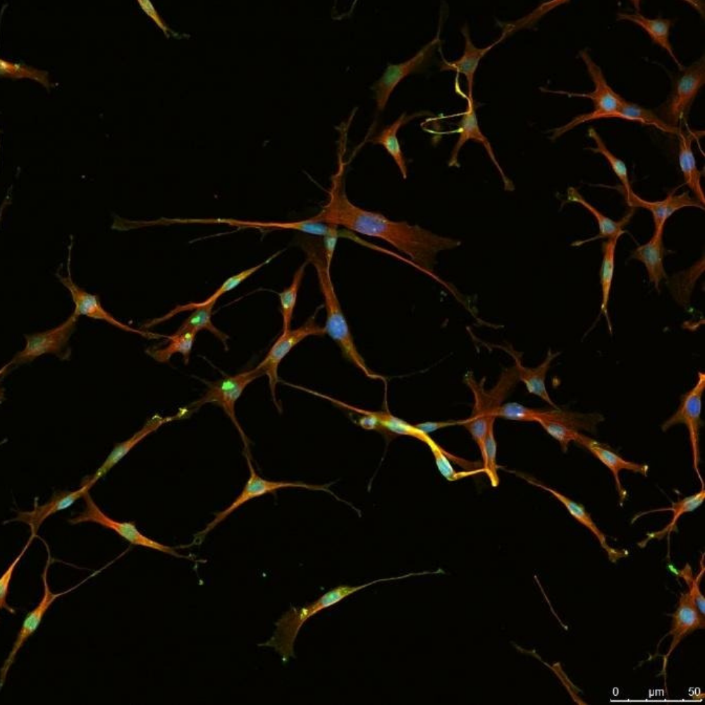 Linea di ricerca 1. Doppia immunofluorescenza di cellule neurali con marker citoscheletrici.