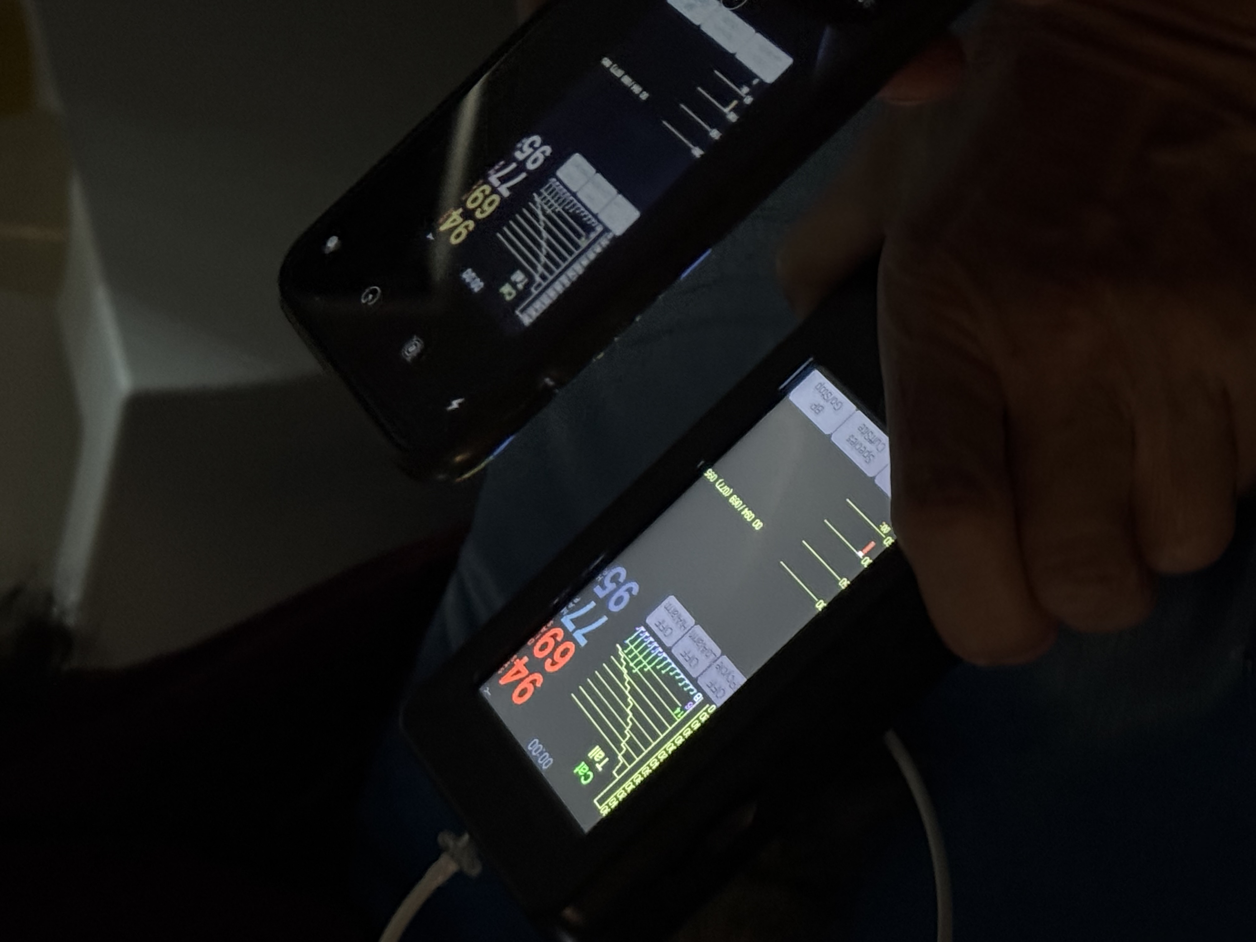 Uno smartphone fotografa i valori e i tracciati sul monitor veterinario durante gli esami su un gatto all’Ospedale Didattico Veterinario di Sassari.